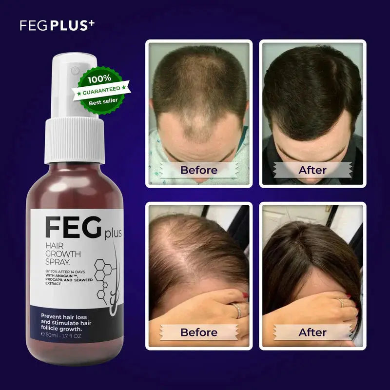 FEG Plus Hair Growth Spray | Strong Hair Regrowth Formula | 50ml