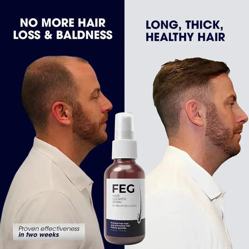 FEG Plus Hair Growth Spray | Strong Hair Regrowth Formula | 50ml